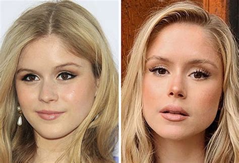 erin moriarty before surgery|Erin Moriarty plastic surgery journey and。